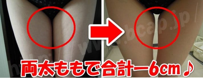 キャビテーションの下半身コースを体験 ビフォーアフター