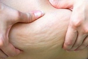 酵素ドリンクでリバウンドした人の特徴とリバウンドしないコツ