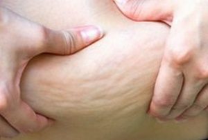酵素ドリンクでリバウンドした人の特徴とリバウンドしないコツ